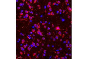 Immunofluorescence of paraffin embedded rat brain using deltex (ABIN7073794) at dilution of 1:200 (400x lens) (Deltex Homolog 1 anticorps)