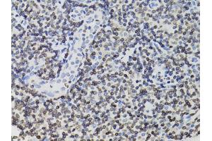 Immunohistochemistry of paraffin-embedded human tonsil using TMPO Antibody (ABIN1875122) at dilution of 1:100 (40x lens). (Thymopoietin anticorps)