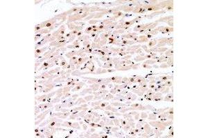 Immunohistochemical analysis of Cyclin E1 (pT77) staining in human heart formalin fixed paraffin embedded tissue section.