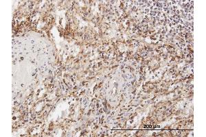 Immunoperoxidase of purified MaxPab antibody to TPP1 on formalin-fixed paraffin-embedded human spleen. (TPP1 anticorps  (AA 1-563))
