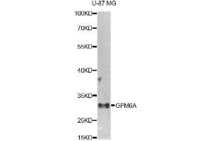 Western blot analysis of extracts of U-87MG cells, using GPM6A antibody (ABIN5995821) at 1/1000 dilution. (GPM6A anticorps)