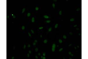 Immunofluorescence staining of Hela Cells with ABIN7127776 at 1:50, counter-stained with DAPI. (Recombinant Caspase 3 anticorps)