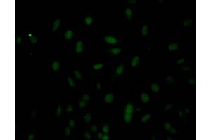 Immunofluorescence staining of Hela Cells with ABIN7127776 at 1:50, counter-stained with DAPI.