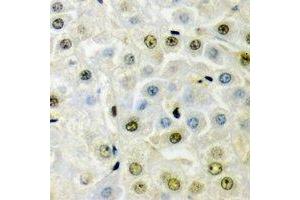 Immunohistochemical analysis of PRDM5 staining in mouse liver formalin fixed paraffin embedded tissue section.