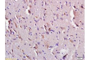 Formalin-fixed and paraffin embedded rat brain labeled with Anti-TMEM2L/KIAA1199 Polyclonal Antibody, Unconjugated (ABIN872432) at 1:200 followed by conjugation to the secondary antibody and DAB staining.