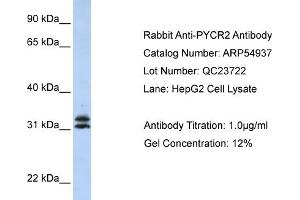 WB Suggested Anti-PYCR2 Antibody Titration: 0. (PYCR2 anticorps  (Middle Region))