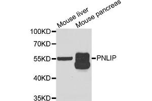 Western blot analysis of extracts of various cell lines, using PNLIP antibody (ABIN5973798) at 1/1000 dilution. (PNLIP anticorps)