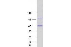 Validation with Western Blot