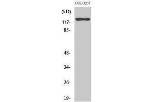 Western Blotting (WB) image for anti-Suppression of Tumorigenicity 5 (ST5) (Internal Region) antibody (ABIN3177531) (ST5 anticorps  (Internal Region))