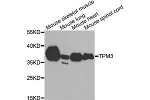 Western blot analysis of extracts of various tissues, using TPM3 antibody. (TPM3 anticorps)