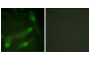 Immunofluorescence analysis of HeLa cells, using Smad2 (Phospho-Thr220) antibody. (SMAD2 anticorps  (pThr220))