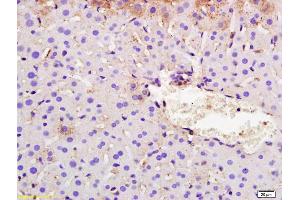 Formalin-fixed and paraffin embedded mouse liver labeled with Rabbit Anti SYVN1/HRD1 Polyclonal Antibody, Unconjugated (ABIN671811) at 1:200 followed by conjugation to the secondary antibody and DAB staining (SYVN1 anticorps  (AA 531-617))