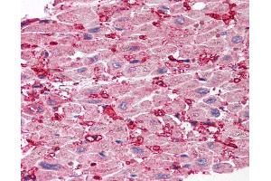 Anti-SCO1 antibody IHC of human heart. (SCO1 anticorps  (Internal Region))
