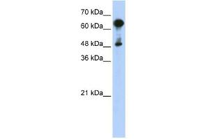 WB Suggested Anti-HSPA6 Antibody Titration: 0.