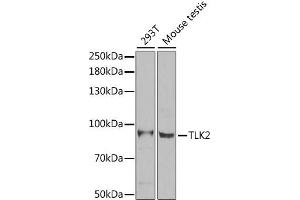 Western blot analysis of extracts of various cell lines, using TLK2 antibody. (TLK2 anticorps)