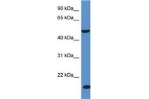 Image no. 1 for anti-Inositol Polyphosphate-5-Phosphatase K (INPP5K) (AA 244-293) antibody (ABIN6746948) (INPP5K anticorps  (AA 244-293))