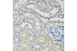 Immunohistochemistry of paraffin-embedded mouse kidney using CHMP1B antibody. (CHMP1B anticorps  (AA 1-199))