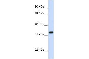 TBCB antibody used at 1 ug/ml to detect target protein. (TBCB anticorps  (C-Term))