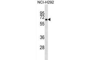 Western Blotting (WB) image for anti-Kelch-like protein 41 (KLHL41) antibody (ABIN2998754) (Kelch-like protein 41 (KLHL41) anticorps)