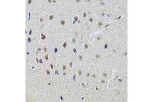 Immunohistochemistry of paraffin-embedded mouse brain using STAT1 antibody (ABIN5969976) at dilution of 1/100 (40x lens).