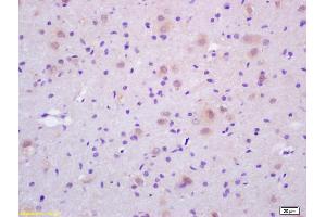 Formalin-fixed and paraffin embedded rat brain labeled with Rabbit Anti CDC37 Polyclonal Antibody, Unconjugated (ABIN706481) at 1:200 followed by conjugation to the secondary antibody and DAB staining (CDC37 anticorps  (AA 291-378))