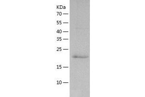Western Blotting (WB) image for Vacuolar Protein-Sorting-Associated Protein 25 (VPS25) (AA 1-200) protein (His-IF2DI Tag) (ABIN7125692)