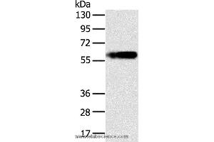 Western blot analysis of Human fat tissue, using PLIN1 Polyclonal Antibody at dilution of 1:200 (PLIN1 anticorps)