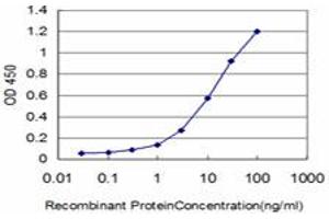 Detection limit for recombinant GST tagged CSF1R is approximately 0. (CSF1R anticorps  (AA 21-120))