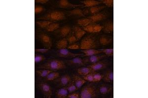 Immunofluorescence analysis of C6 cells using CEP85 antibody (ABIN7266281) at dilution of 1:100. (CEP85 anticorps  (AA 130-430))
