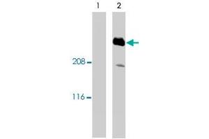 Western blotting total cellular protein from cultured rat aortic smooth muscle cells was preparedand analyze.