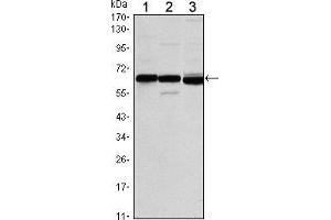 Western blot analysis using ESR1 mouse mAb against MCF-7 (1), T47D (2) and SKBR3 (3) cell lysate. (Estrogen Receptor alpha anticorps)