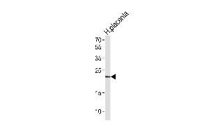 Western blot analysis of lysate from human placenta tissue lysate,using HES2 Antibody was diluted at 1:1000. (HES2 anticorps)