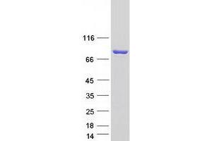 Validation with Western Blot