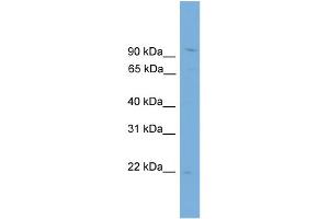 WB Suggested Anti-TPPP3 Antibody Titration:  0. (TPPP3 anticorps  (N-Term))