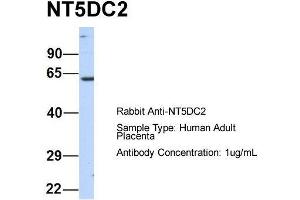 Host:  Rabbit  Target Name:  NT5DC2  Sample Type:  Human Adult Placenta  Antibody Dilution:  1. (NT5DC2 anticorps  (N-Term))