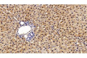 Detection of ALT in Rat Liver Tissue using Polyclonal Antibody to Alanine Aminotransferase (ALT)