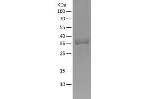 Caveolin 1, Caveolae Protein, 22kDa (CAV1) (AA 2-104) protein (His-IF2DI Tag)