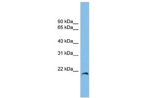 WB Suggested Anti-CIRBP Antibody Titration: 0. (CIRBP anticorps  (Middle Region))