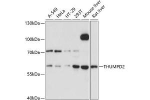 anti-THUMP Domain Containing 2 (THUMPD2) (AA 404-503) antibody