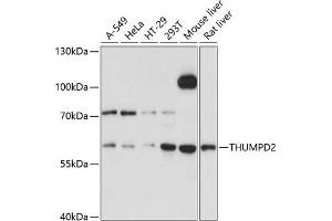 Western blot analysis of extracts of various cell lines, using THUMPD2 Antibody (ABIN6128828, ABIN6149131, ABIN6149132 and ABIN6215413) at 1:3000 dilution. (THUMPD2 anticorps  (AA 404-503))