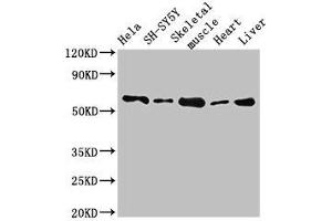 Western Blot Positive WB detected in: Hela whole cell lysate, SH-SY5Y whole cell lysate, Mouse skeletal muscle tissue, Rat heart tissue, Rat liver tissue All lanes: ASNS antibody at 2. (Asparagine Synthetase anticorps  (AA 364-551))