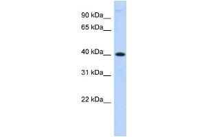WB Suggested Anti-MPPE1 Antibody Titration:  0. (MPPE1 anticorps  (N-Term))