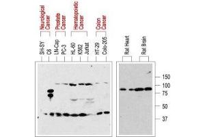 Western blot analysis of normal rat tissue (right) and in human cancer cell lines (left): - p75NTR is visualized with Anti-p75 NGF Receptor (extracellular) Antibody (ABIN7043344, ABIN7044755 and ABIN7044756), (1:200). (NGFR anticorps  (Extracellular, Stalk Region))