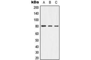 Western blot analysis of Alpha-adducin (pT445) expression in HEK293T (A), mouse brain (B), rat brain (C) whole cell lysates. (alpha Adducin anticorps  (pSer445))