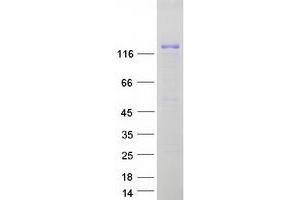 Validation with Western Blot