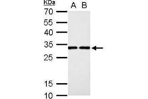 WB Image DCK antibody detects DCK protein by Western blot analysis. (DCK anticorps)