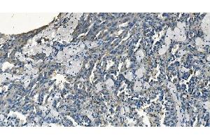 IHC analysis of GABARAP using anti-GABARAP antibody (ABIN7603159). (GABARAP anticorps  (N-Term))