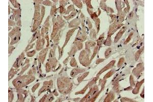 Immunohistochemistry of paraffin-embedded human heart tissue using ABIN7164781 at dilution of 1:100 (P4HA1 anticorps  (AA 256-525))