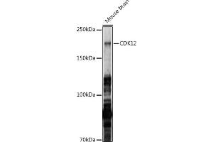 Western blot analysis of extracts of Mouse brain, using CDK12 antibody (ABIN7266230) at 1:1000 dilution. (CDK12 anticorps  (AA 80-290))