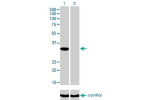Western blot analysis of ITPK1 over-expressed 293 cell line, cotransfected with ITPK1 Validated Chimera RNAi (Lane 2) or non-transfected control (Lane 1). (ITPK1 anticorps  (AA 1-314))
